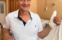 Львівські хірурги врятували львів'янину відірваний великий палець