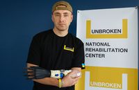 У Львові у реабілітаційному центрі встановили перший біонічний протез руки
